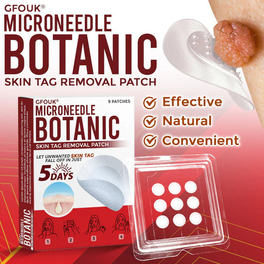 Smooth Skin Tag Remover